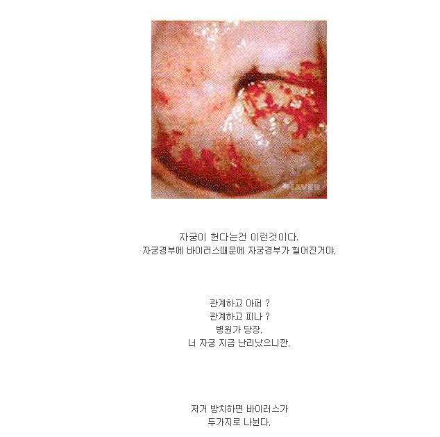 한돈과혐스위험한이유 (4).png 한돈과혐스위험한이유 (4).png