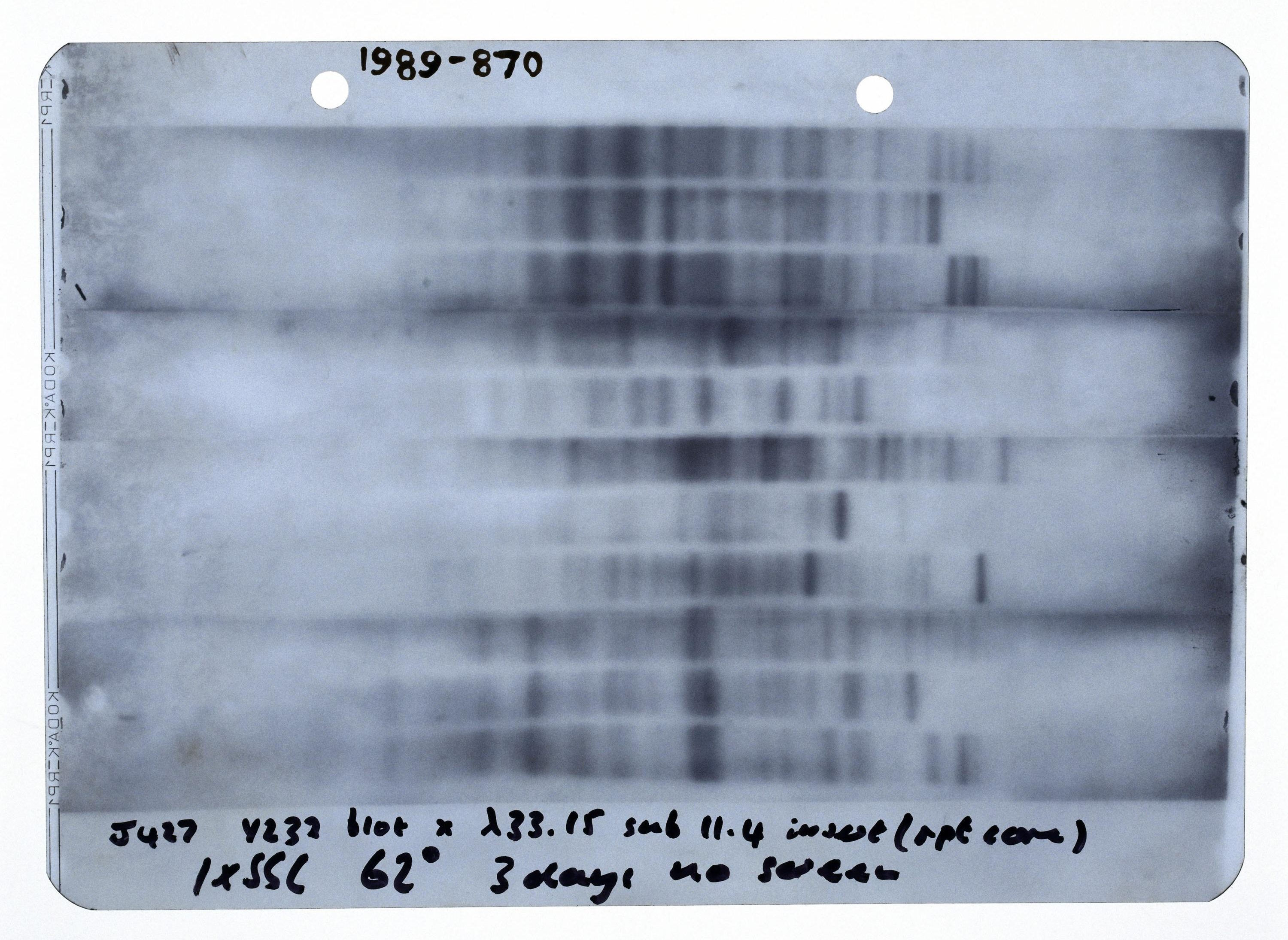 First-genetic-fingerprint-1984-Science-Museum-Group-Collection-e1534774576414.jpeg