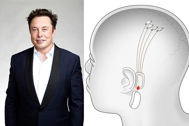Elon-Musk-neuralink-music-brain-chip.jpg